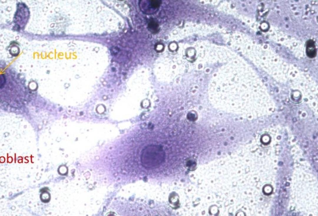 A snapshot of Emma's research: rheumatoid arthritis synovial fibroblasts that have invaded through an experimental chamber.